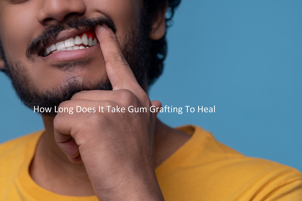 How Long Does It Take Gum Grafting To Heal